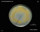 Vibrio cholerae on TCBS agar